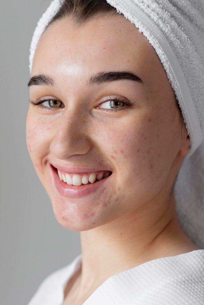 2148934201 (1) Fade Dark Spots & Hyperpigmentation<br />