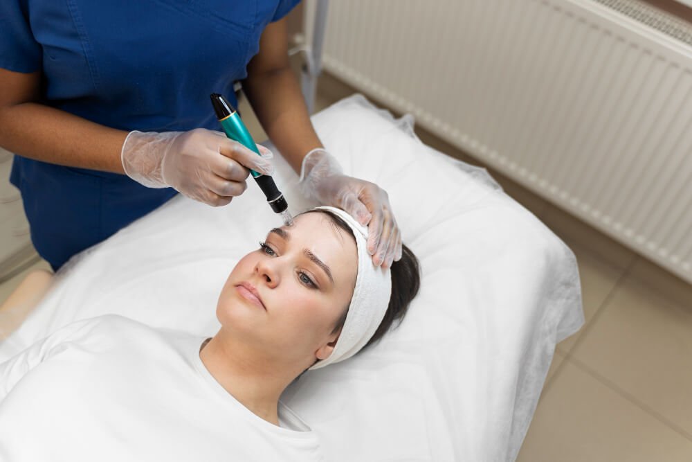 2149334261 (1) Microneedling<br />